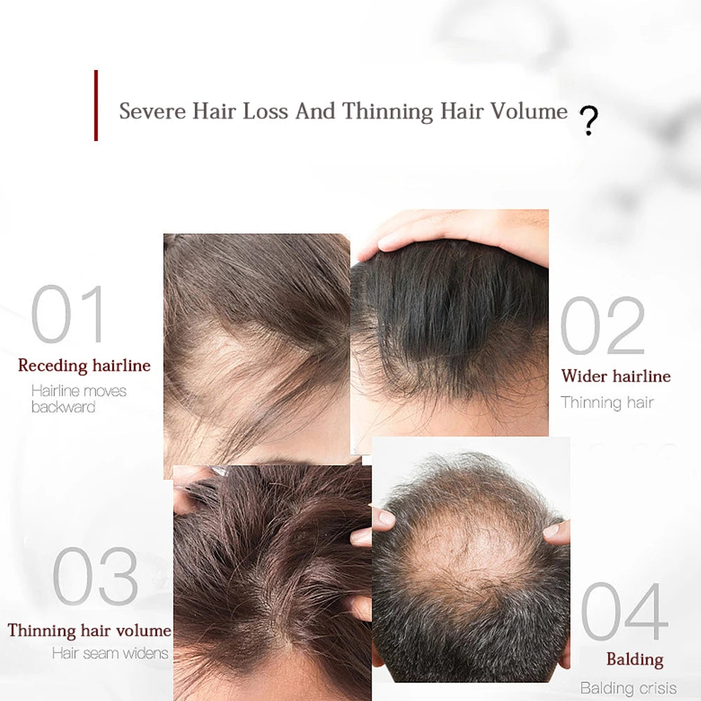 High-Frequency Scalp Massage Comb – Anti-Hair Loss Treatment
