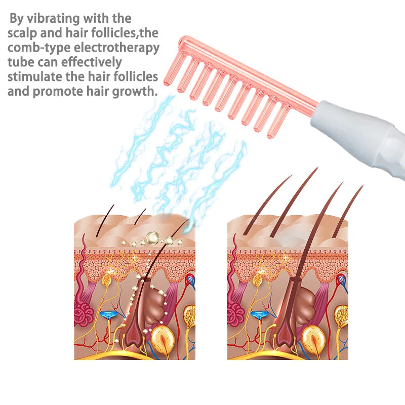 High-Frequency Scalp Massage Comb – Anti-Hair Loss Treatment 